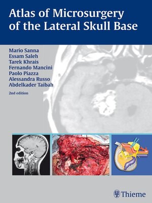 cover image of Atlas of Microsurgery of the Lateral Skull Base